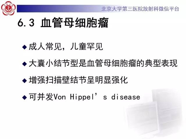 【病例】髓母细胞瘤1例MR影像诊断与鉴别