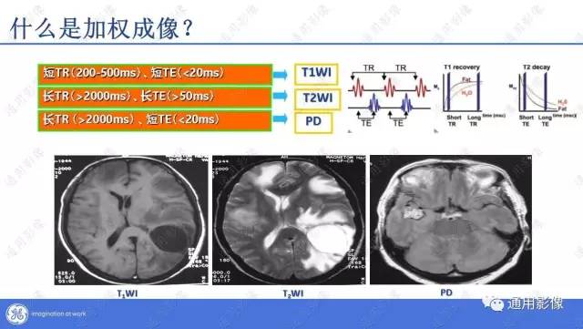 【PPT】T1WI的故事