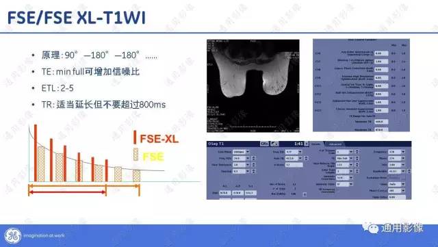 【PPT】T1WI的故事