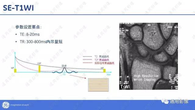 【PPT】T1WI的故事
