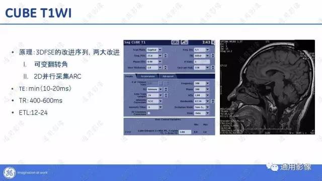 【PPT】T1WI的故事