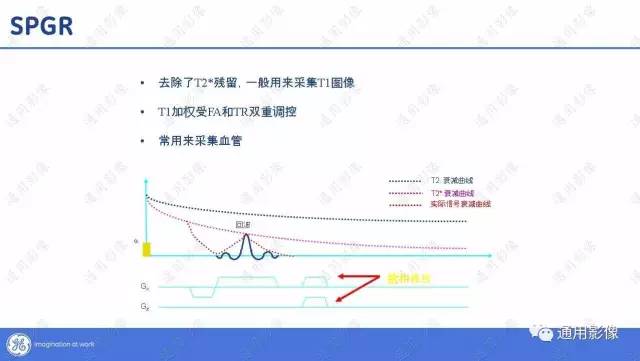 【PPT】T1WI的故事