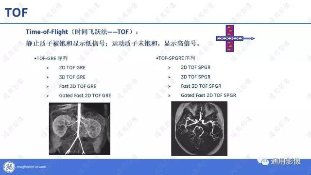 【PPT】T1WI的故事