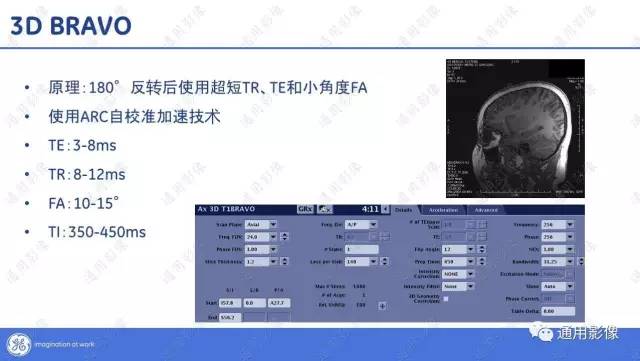 【PPT】T1WI的故事