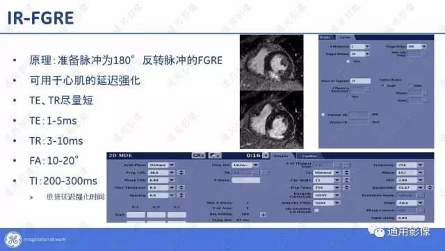 【PPT】T1WI的故事