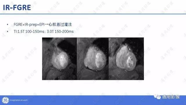 【PPT】T1WI的故事