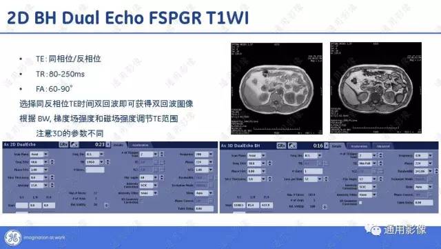 【PPT】T1WI的故事