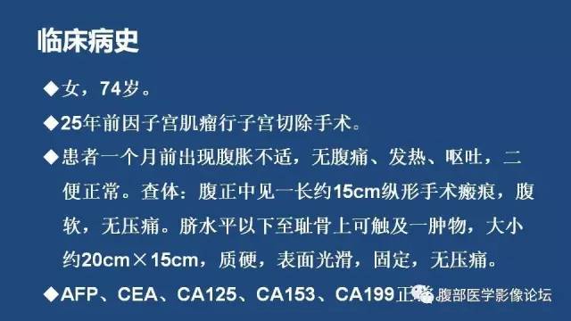 【病例】左侧卵巢间质肉瘤伴出血坏死囊变1例