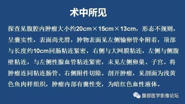 【病例】左侧卵巢间质肉瘤伴出血坏死囊变1例