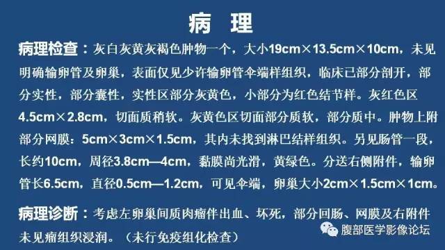 【病例】左侧卵巢间质肉瘤伴出血坏死囊变1例