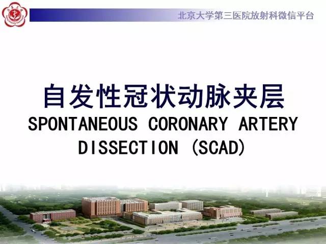 【病例】自发性冠状动脉夹层1例