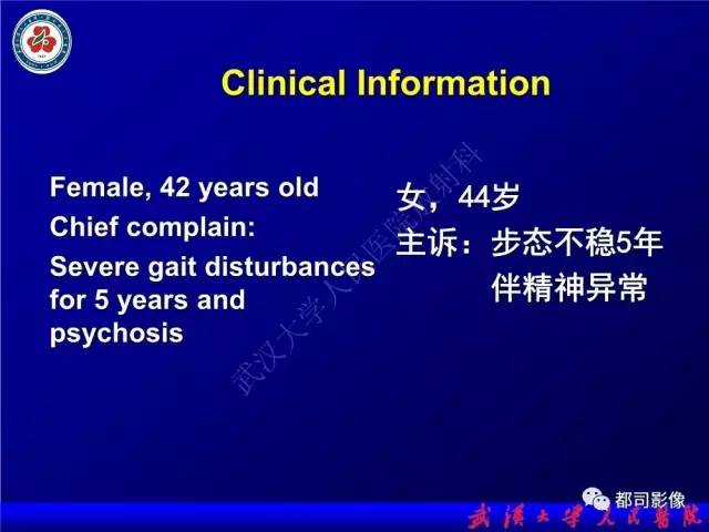 【PPT】脑腱黄瘤病影像诊断