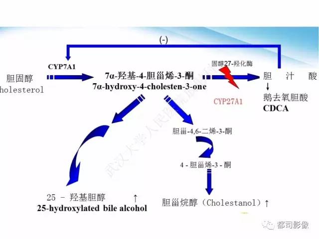 【PPT】脑腱黄瘤病影像诊断