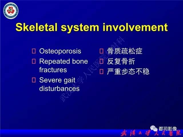 【PPT】脑腱黄瘤病影像诊断