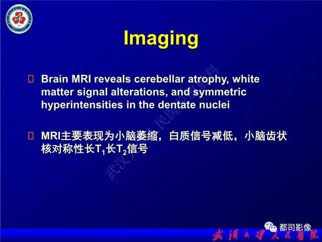 【PPT】脑腱黄瘤病影像诊断