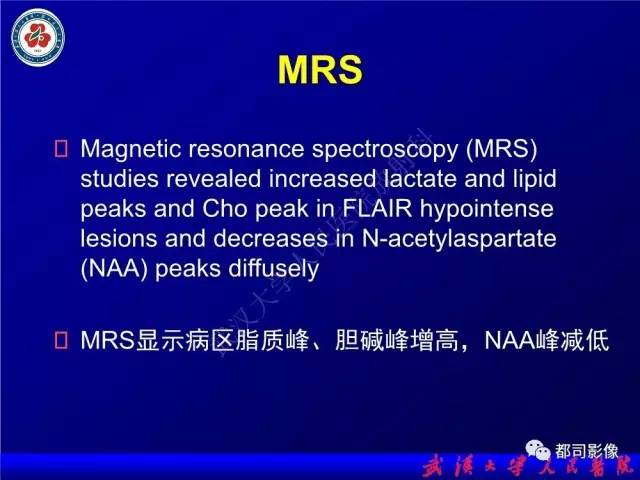 【PPT】脑腱黄瘤病影像诊断