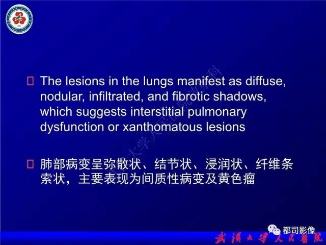 【PPT】脑腱黄瘤病影像诊断