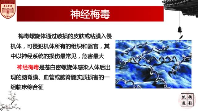 【病例】梅毒树胶样肿1例MR影像诊断与鉴别