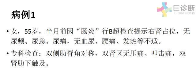 【病例】肾脏肿瘤4例影像诊断与鉴别