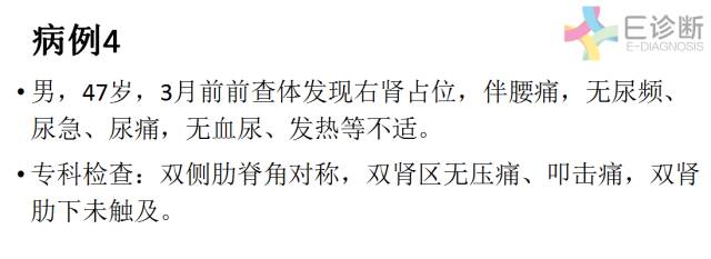 【病例】肾脏肿瘤4例影像诊断与鉴别