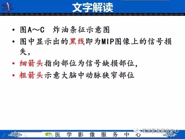 【影像征象】炸油条征