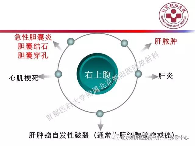 【PPT】急腹症影像诊断思路
