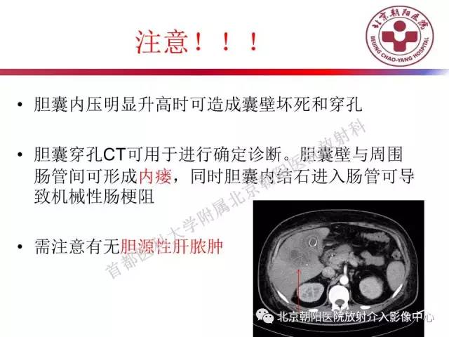 【PPT】急腹症影像诊断思路