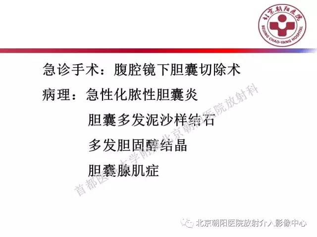 【PPT】急腹症影像诊断思路