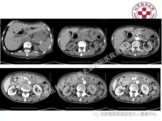【PPT】急腹症影像诊断思路
