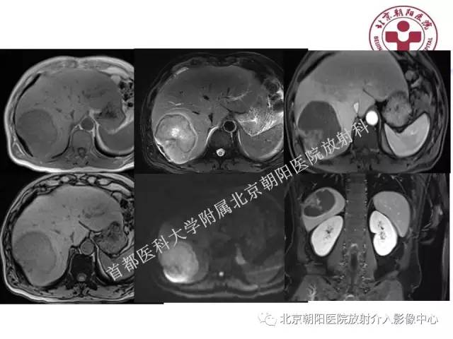 【PPT】急腹症影像诊断思路