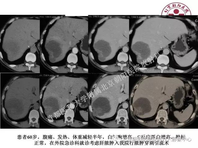 【PPT】急腹症影像诊断思路