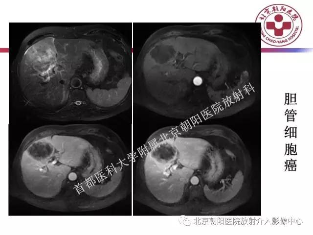 【PPT】急腹症影像诊断思路