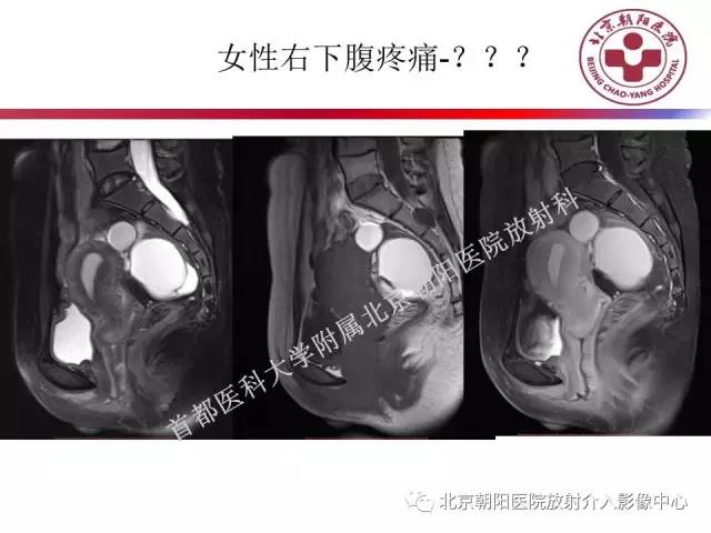 【PPT】急腹症影像诊断思路
