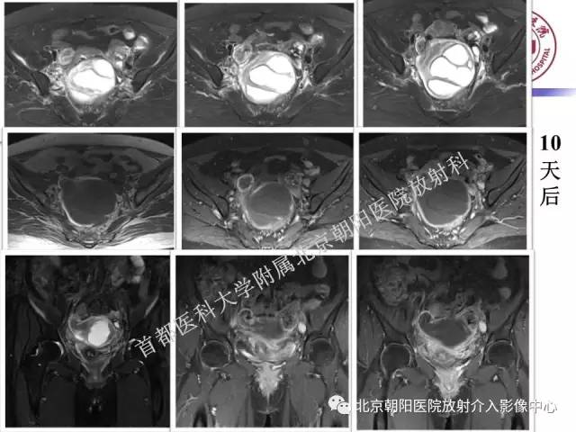 【PPT】急腹症影像诊断思路