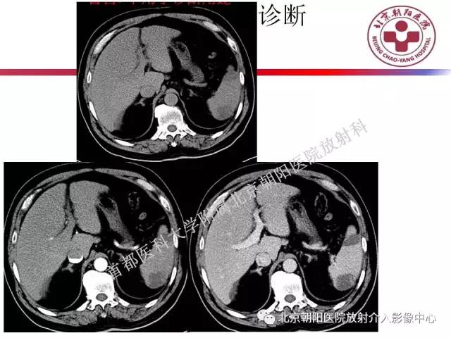 【PPT】急腹症影像诊断思路