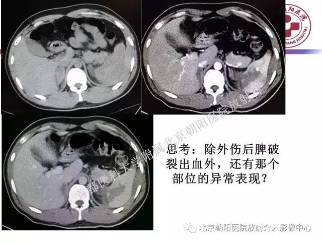 【PPT】急腹症影像诊断思路