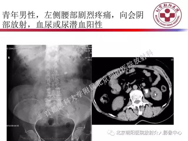 【PPT】急腹症影像诊断思路