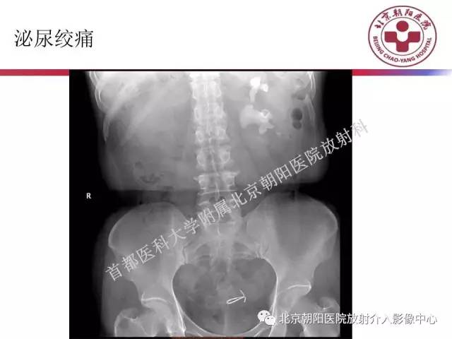 【PPT】急腹症影像诊断思路
