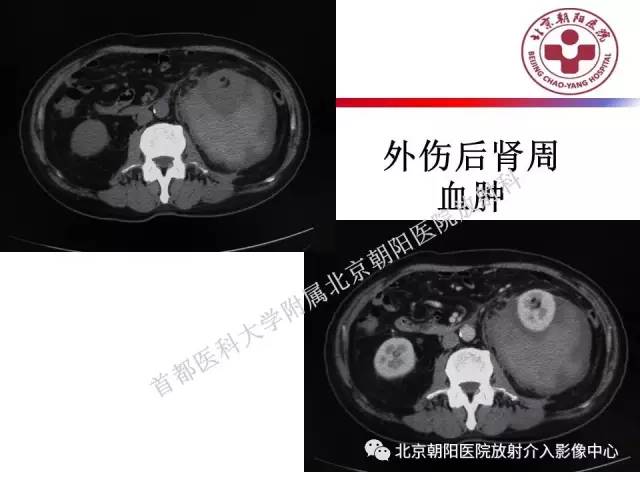 【PPT】急腹症影像诊断思路