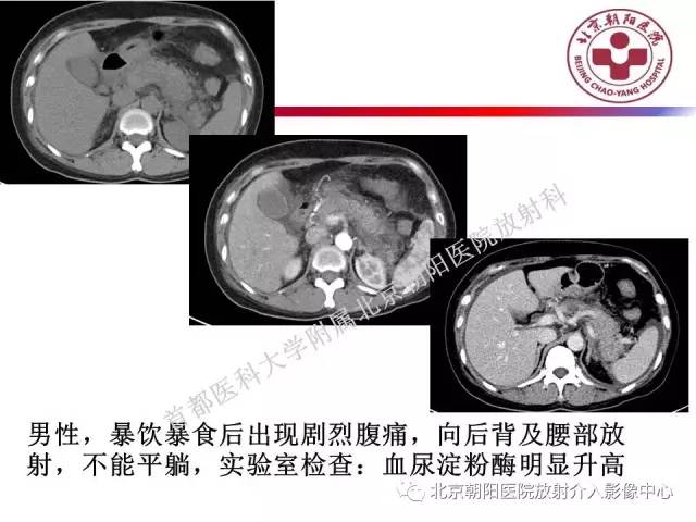 【PPT】急腹症影像诊断思路