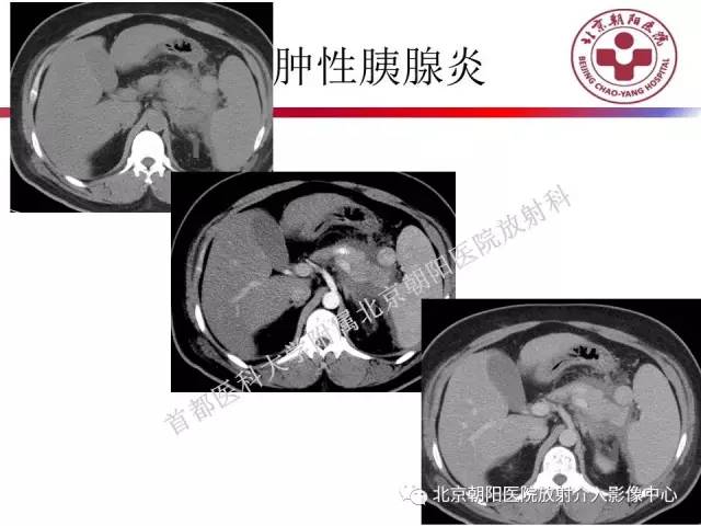 【PPT】急腹症影像诊断思路