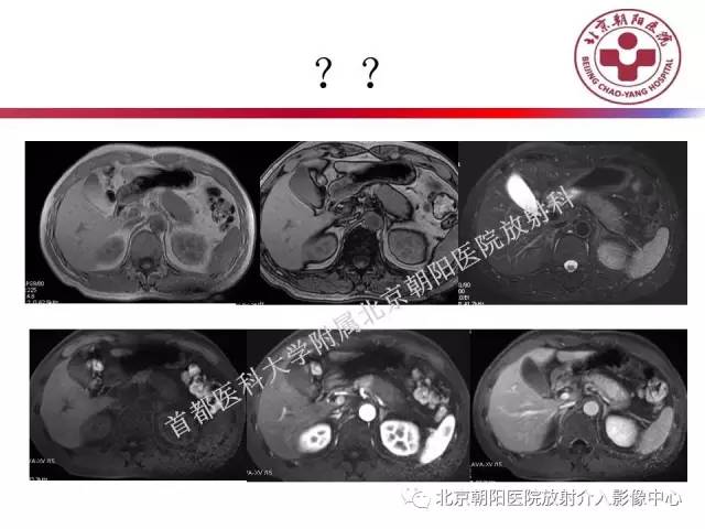 【PPT】急腹症影像诊断思路