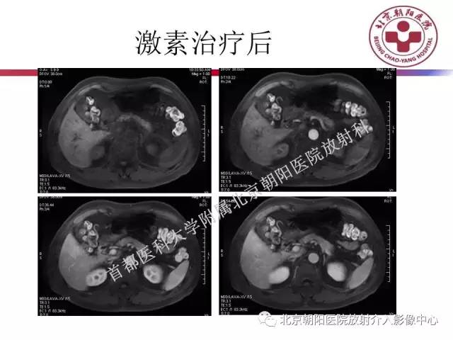 【PPT】急腹症影像诊断思路