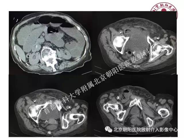 【PPT】急腹症影像诊断思路