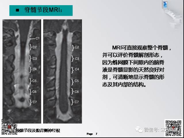 【PPT】脊髓的解剖与临床综合征