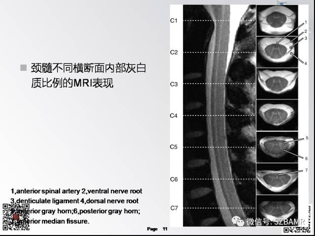 【PPT】脊髓的解剖与临床综合征