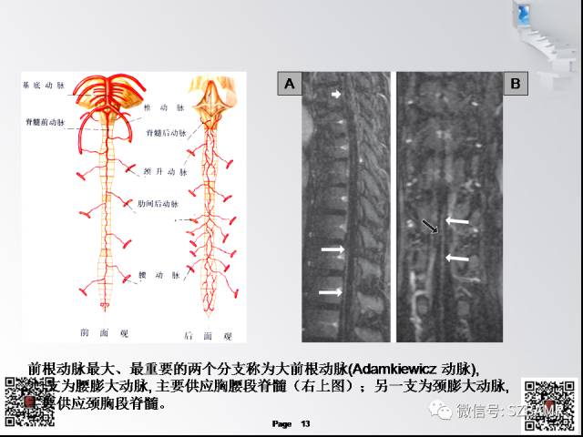 【PPT】脊髓的解剖与临床综合征