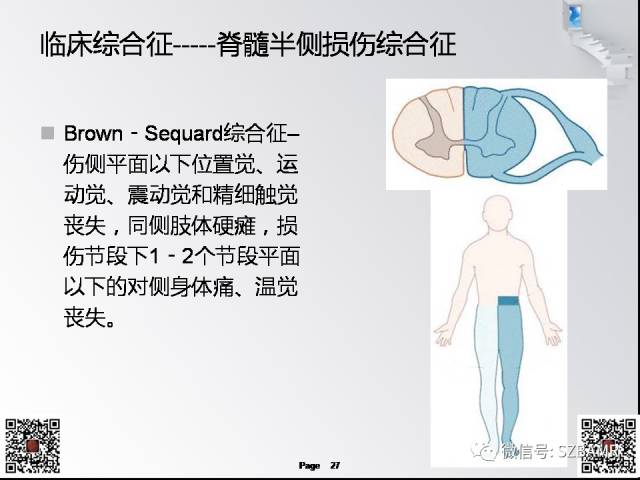 【PPT】脊髓的解剖与临床综合征