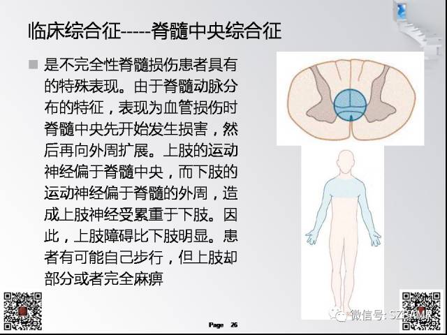 【PPT】脊髓的解剖与临床综合征