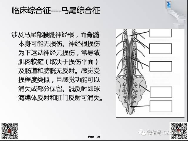 【PPT】脊髓的解剖与临床综合征